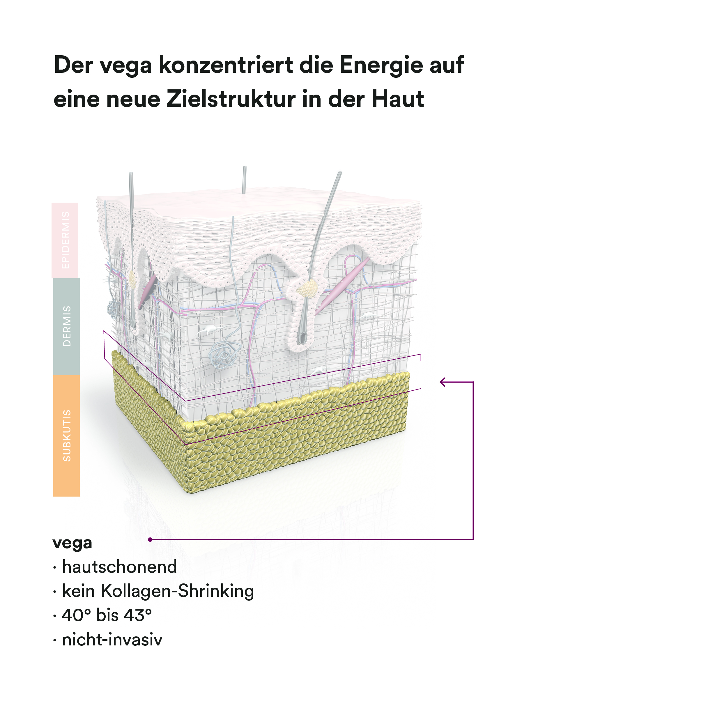 Vega Beispielbild Haut